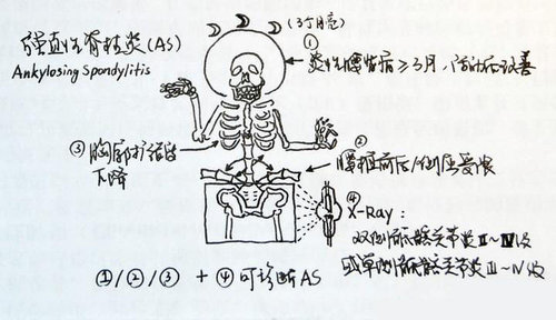 ǿֱÐÔ¼¹ÖùÑ×.jpg