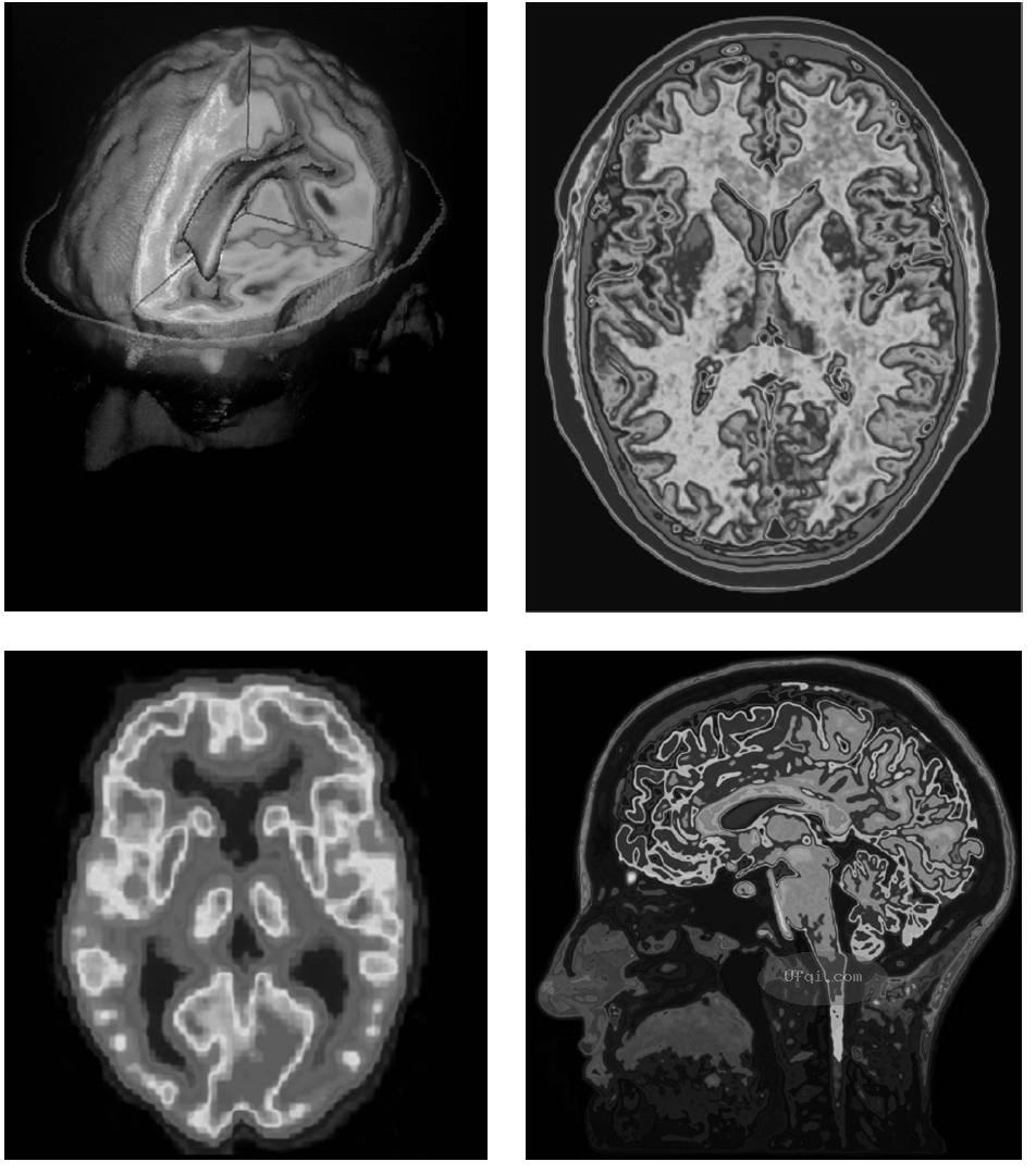 津巴多普通心理学 Psychology: Core Concepts-6: 第二章 生物心理学,神经科学与人类天性-13