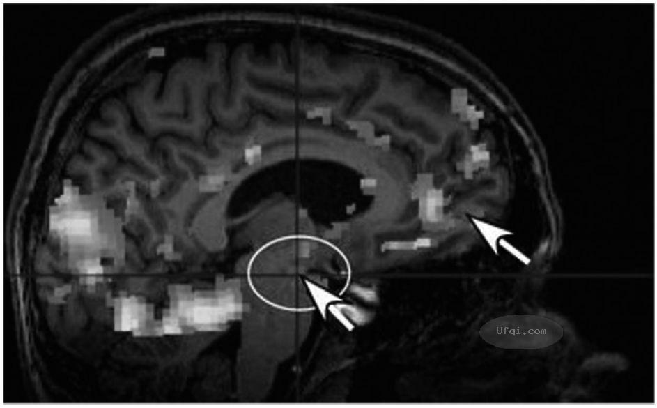 津巴多普通心理学 Psychology: Core Concepts-10: 第六章 思维与智力-4